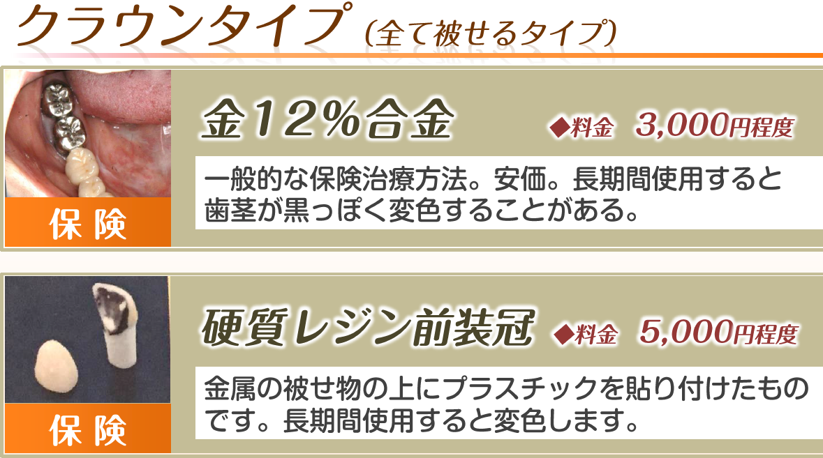 歯の被せ物（クラウン・保険タイプ）