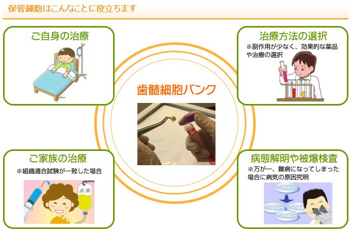 再生医療について